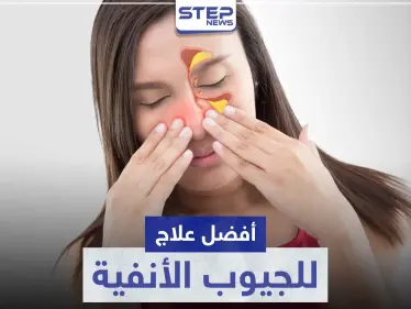 أفضل علاج للجيوب الأنفية طبيعياً و طبياً - وكالة ستيب نيوز