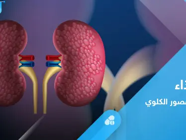 القصور الكلوي.. إليك النظام الغذائي الأمثل لتجنب تفاقم المرض - وكالة ستيب نيوز