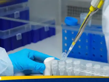 اكتشاف فيروس خطير في أستراليا - وكالة ستيب نيوز