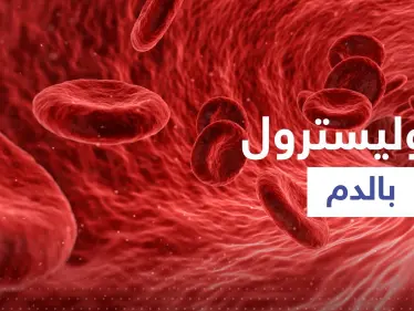 "تصيب الساق ويمكن أن تكون خطيرة".. أول علامة لارتفاع نسبة الكوليسترول - وكالة ستيب نيوز