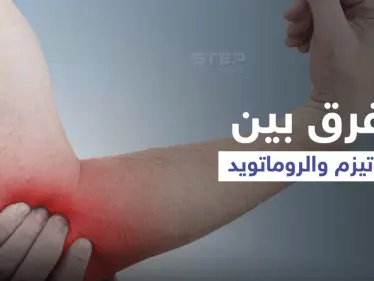 الفرق بين الروماتيزم والروماتويد.. إليك أهم المعلومات - وكالة ستيب نيوز