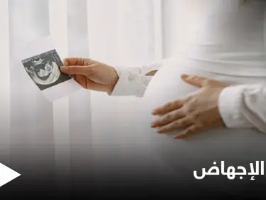 "نبض الجنين".. ولاية تكساس تتخذ قراراً مصيرياً يخص الإجهاض - وكالة ستيب نيوز