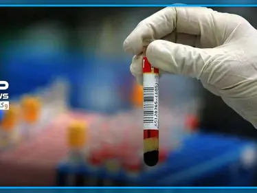 سيهمك التعرف إليها.. علماء ووهان يكشفون زمر الدم الأكثر والأقل عرضة للإصابة بكورونا - وكالة ستيب نيوز