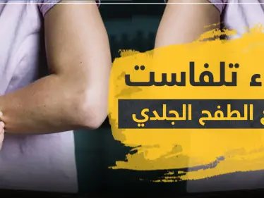 دواء تلفاست لعلاج الطفح الجلدي - وكالة ستيب نيوز