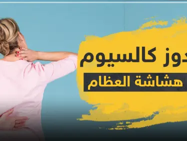 دواء sandoz ساندوز كالسيوم لعلاج هشاشة العظام - وكالة ستيب نيوز