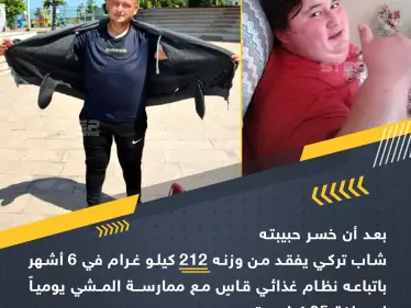 شاب تركي يخسر 212 كغ من وزنه باتباع نظام غذائي قاسِ - وكالة ستيب نيوز