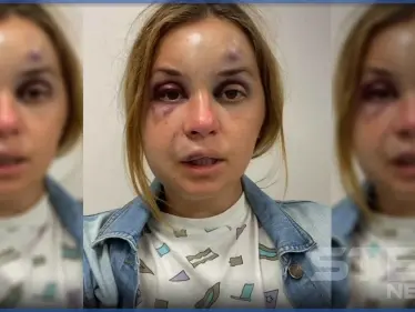 بالفيديو|| مذيعة أوكرانية تعرضت لضرب عنيف ومحاولة "اغتصاب" وتكشف كيف تمكنت من الهرب - وكالة ستيب نيوز