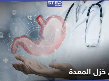 ما هو مرض خزل المعدة وكيف يعطل عمل الجهاز الهضمي وأسبابه وطرق العلاج - وكالة ستيب نيوز