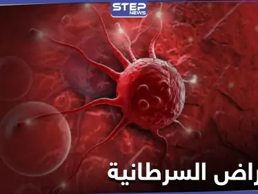 نصائح هامة عليك معرفتها.. لتجنب الإصابة بالأمراض السرطانية القاتلة - وكالة ستيب نيوز