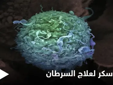 "قنبلة سكر" تقضي على خلايا السرطان في ثوان... آخر ما توصل إليه العلماء لإنقاذ 8 مليون شخص سنوياً من الموت - وكالة ستيب نيوز