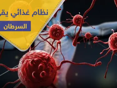 تخلص من مرض السرطان باتباعك هذا النظام الغذائي.. علماء يوضحون الطريقة - وكالة ستيب نيوز
