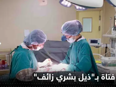 شاهد|| بظاهرة نادرة للغاية.. ولادة فتاة في البرازيل بـ"ذيل بشري زائف" - وكالة ستيب نيوز