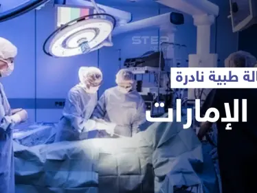 في حالة طبية نادرة... إماراتية ظنت أنها مريضة سرطان لتكتشف أنها تمتلك "طحالين" والطبيب يوضح - وكالة ستيب نيوز