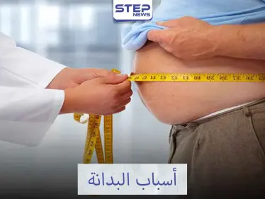 تعرف على أسباب البدانة - وكالة ستيب نيوز