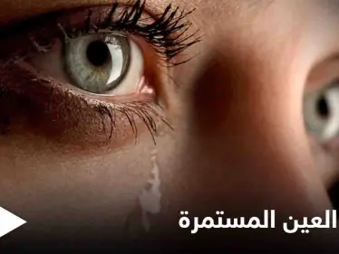 تعرف على أسباب دموع العين المستمرة وطرق علاجها - وكالة ستيب نيوز
