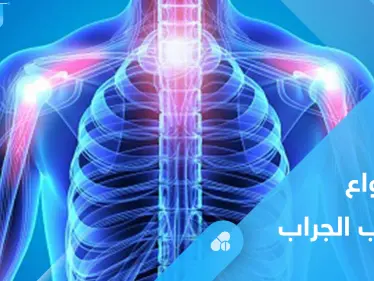 التهاب الجراب وآلام المفاصل.. كل ما عليك معرفته - وكالة ستيب نيوز