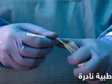 الإعلان لأول مرة عن شخص مصاب بكورونا والإيدز وجدري القردة معاً - وكالة ستيب نيوز