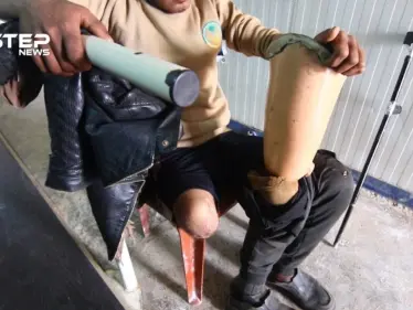 بجهود محلية مركز الخطوات السعيدة الأول من نوعه لتصنيع الأطراف الصناعية في الداخل السوري - وكالة ستيب نيوز