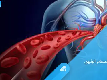 خطورة ضيق الصمام الرئوي وطرق العلاج.. إليك أهم المعلومات - وكالة ستيب نيوز