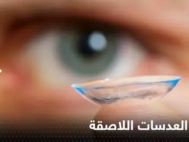شاب يفقد بصره جزئياً بسبب العدسات اللاصقة.. وخبراء يحذرون - وكالة ستيب نيوز