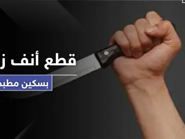 "قطع أنفها بالسكين".. رجل يعتدي على زوجته خلال الحظر لطلبها هذا الأمر - وكالة ستيب نيوز