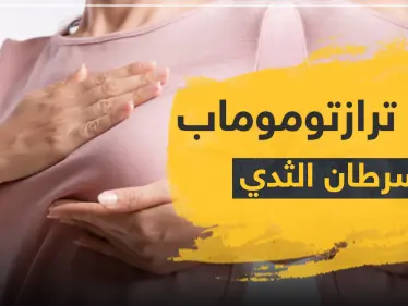 دواء ترازتوموماب لسرطان الثدي - وكالة ستيب نيوز