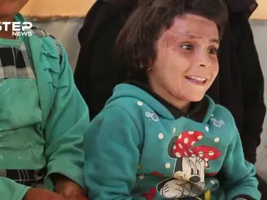 حياة قيد الموت ولعنة الحرب تلاحقها والأمل والصبر سلاحها ... روضة العلي هذه قصتي - وكالة ستيب نيوز