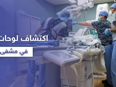 لوحات فنية بقيمة تتجاوز 100 ألف دولار اكتشفت صدفةً في مشفى أمريكي - وكالة ستيب نيوز