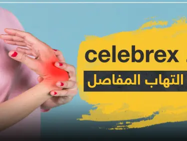دواء celebrex لعلاج التهاب المفاصل - وكالة ستيب نيوز