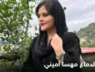 شاهد|| صورة لدماغ مهسا أميني تكشف تفاصيل ما حدث.. وعرض وجوه الجناة لأول مرة - وكالة ستيب نيوز