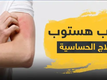 حبوب هستوب لعلاج الحساسية - وكالة ستيب نيوز