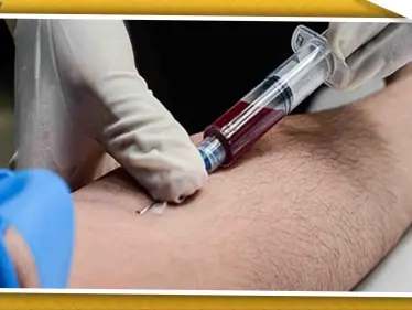 أرقام مرعبة لمرضى "الإيدز" في روسيا، والأمم المتحدة تحذّر - وكالة ستيب نيوز