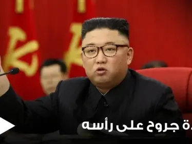 شاهد|| كدمة وضمادة جروح على رأسه.. زعيم كوريا الشمالية يثير الجدل بظهوره الأخير - وكالة ستيب نيوز