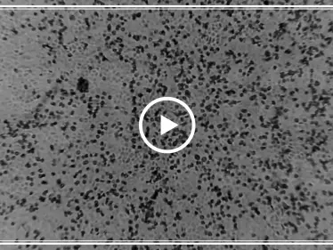 أوّل فيديو يظهر مراحل التطور السريع لفيروس "كورونا".. وعلماء يكتشفون نقطة التحول - وكالة ستيب نيوز