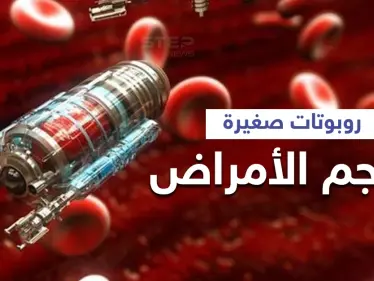 لعلاج السرطان والأمراض المستعصية..روبوتات مرنة تدخل جسم الإنسان وتهاجم الإصابة إليك التفاصيل - وكالة ستيب نيوز