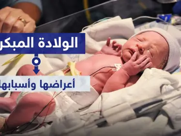 الولادة المبكرة.. أعراضها وأسبابها - وكالة ستيب نيوز