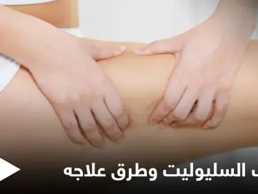 ماهو السليوليت ومأ أسبابه وإصابته للنساء بشكل أكبر إليك أهم المعلومات - وكالة ستيب نيوز