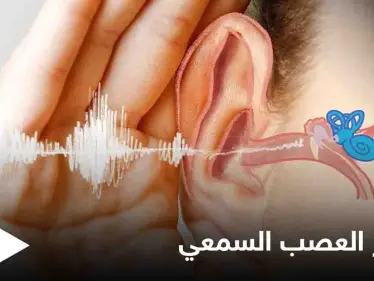 تعرف على مرض ضمور العصب السمعي أسبابه وأعراضه وطرق العلاج - وكالة ستيب نيوز