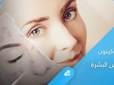 دواء هيدروكينون لتبييض البشرة وإزالة التصبغات.. طرق الاستخدام والآثار الجانبية إليك أهم المعلومات - وكالة ستيب نيوز