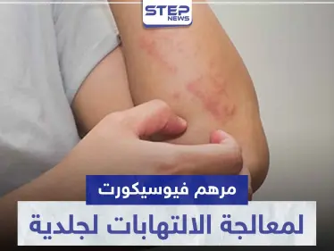 مرهم فيوسيكورت FUCICORT لمعالجة الالتهابات لجلدية - وكالة ستيب نيوز