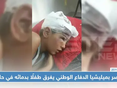 عنصر بميليشيا الدفاع الوطني يغرق طفلًا بدمائه في حلب.. والسبب!! - وكالة ستيب نيوز