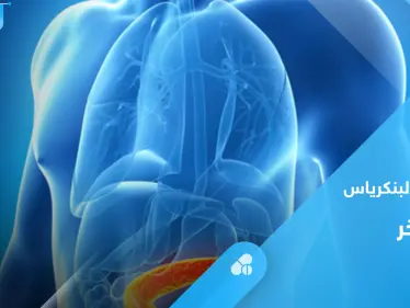 ما هو التهاب البنكرياس الناخر.. إليك كل ما تحتاج معرفته عنه - وكالة ستيب نيوز