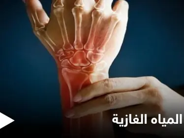 منها تعزيز صحة العظام.. تعرف على فوائد المياه الغازية ومضارها الجانبية - وكالة ستيب نيوز