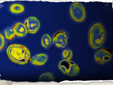 علماء يحذرون من تفشي فطريات قاتلة بسبب التكيف مع الحر - وكالة ستيب نيوز