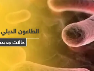 بعد الصين ومنغوليا.. الطاعون الدبلي يطرق باب أمريكا والسلطات تستعد - وكالة ستيب نيوز