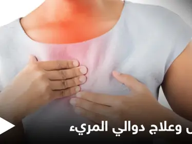 ما هي دوالي المريء وأعراضها وطرق علاجها إليك أهم المعلومات - وكالة ستيب نيوز