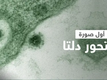 شاهد مجهر إلكتروني يلتقط أول صورة لـ متحور دلتا ينمو كخلايا القرد الأفريقي (صورة) - وكالة ستيب نيوز