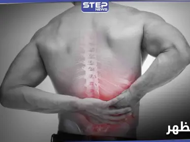 ألم الظهر من أمراض العصر الشائعة تعرف إلى أسبابه وعلاج حالاته البسيطة والخطيرة - وكالة ستيب نيوز