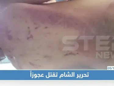 بالصور: مقتل رجل تحت التعذيب بسجون هيئة تحرير الشام - وكالة ستيب نيوز