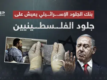 أثار الجدل في وسط حرب غـ..ـزة… ما هو بنك الجلد الإسرائيلي - وكالة ستيب نيوز